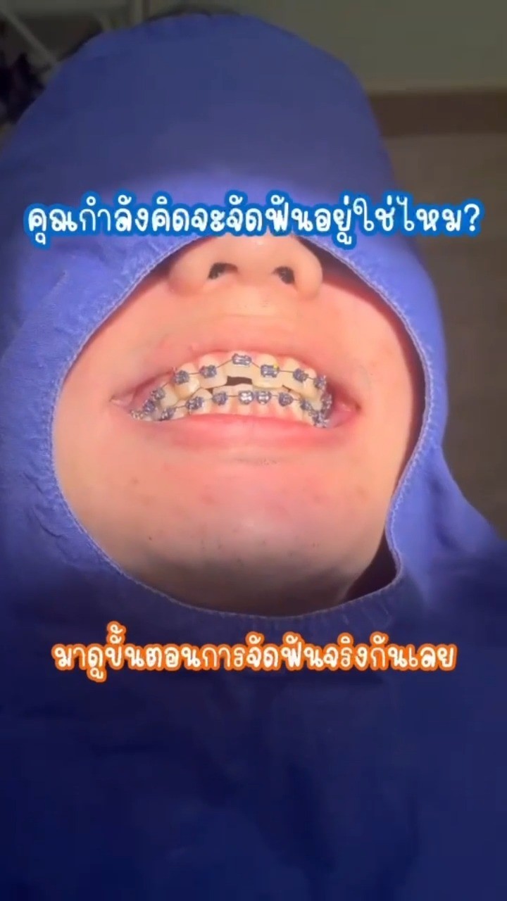 อยากจัดฟัน แต่ไม่รู้ต้องเริ่มยังไง? 🤔ดูจบรู้ครบทุกขั้นตอน
📢พร้อมโปรแรงที่คุณไม่ควรพลาด!✨
#จัดฟัน #จัดฟันพิษณุโลก #คลินิกทันตกรรม #ฟันสวย #ยิ้มสวย  #beforeafter 
#โปรจัดฟัน #รีวิวจัดฟัน #คลินิกจัดฟันใกล้ฉัน